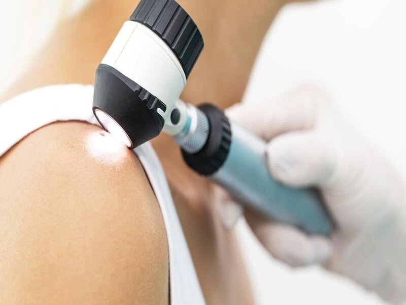 Skin Screening - Examination at the dermatologist