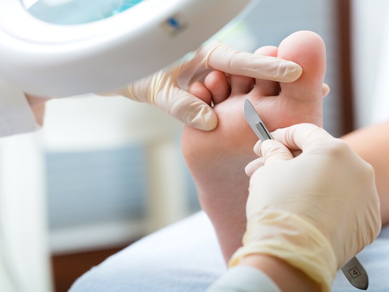 Podiatry procedure image -1